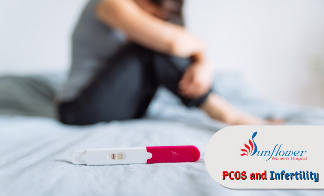 PCOS and Infertility