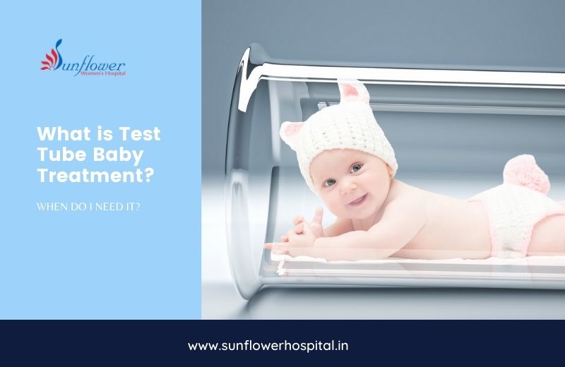 What is Test Tube Baby Treatment? When do I need it?