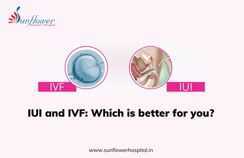 IUI and IVF: Which is better for you?