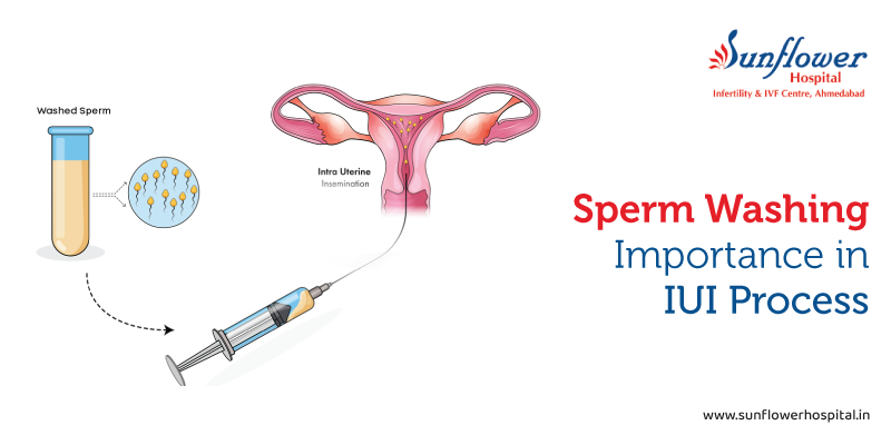 The Science of Sperm Washing: Why It’s Essential for IUI Success