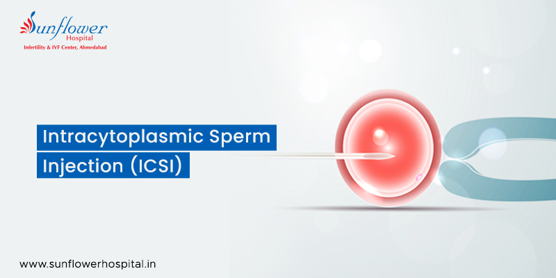What is Intracytoplasmic Sperm Injection (ICSI)?