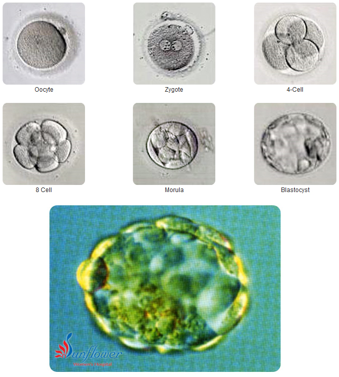 Blastocyst Transfer