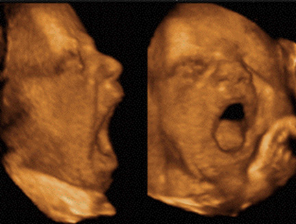 Sonography Image