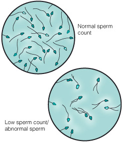 SPERM COUNT