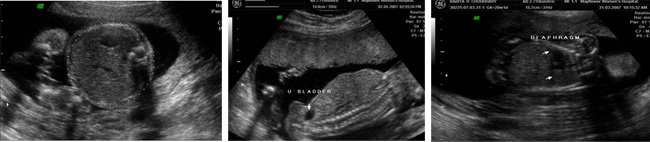 Sonography Image