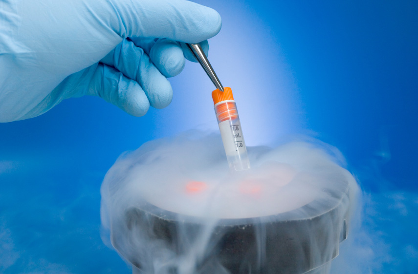 Cryopreservation 