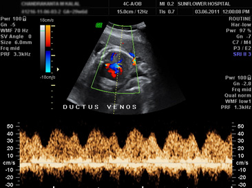 Sonography Image