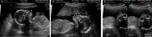 Sonography Image