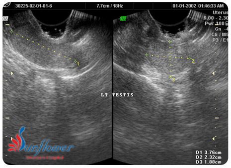 male-partner1