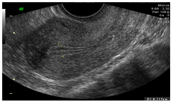 ultrasound image