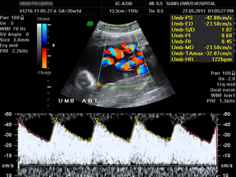 Sonography Image