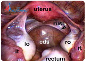 Role of Endoscopy 2