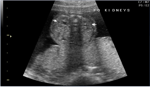 Sonography Image