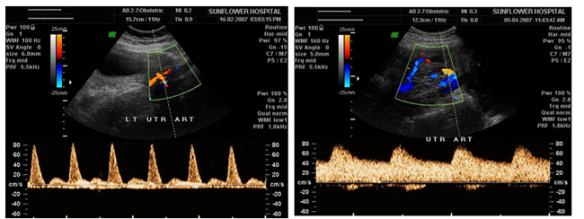 Sonography  Image