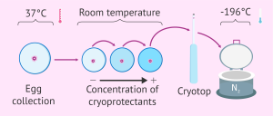 IVF Image