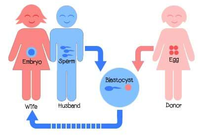 Egg Donation 1