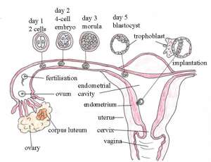 IVF