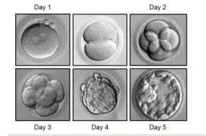 IVF Image