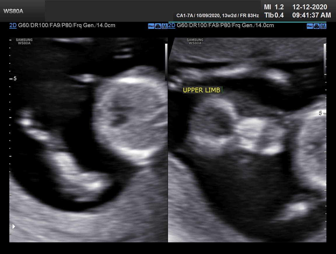 Sonography Image