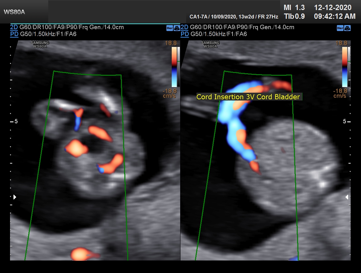 Sonography Image