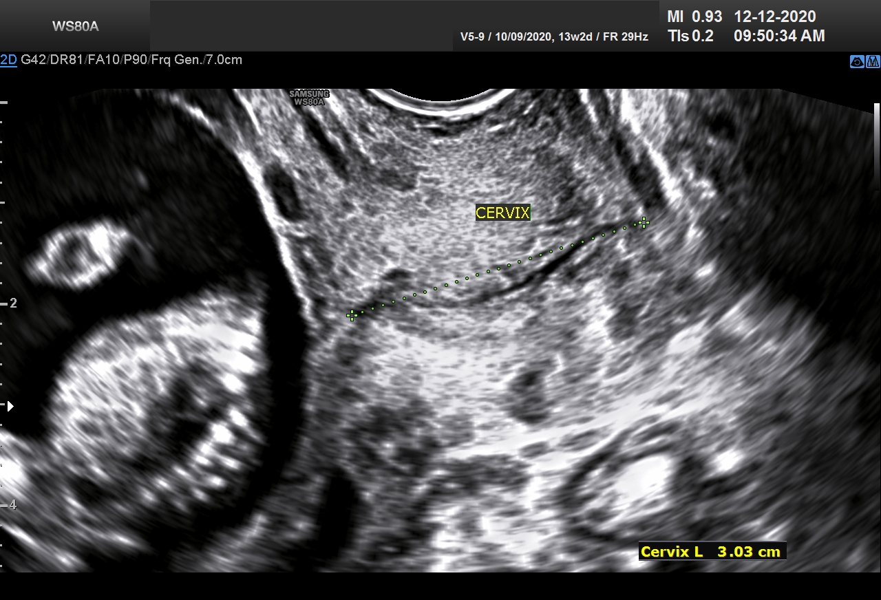 Sonography Image