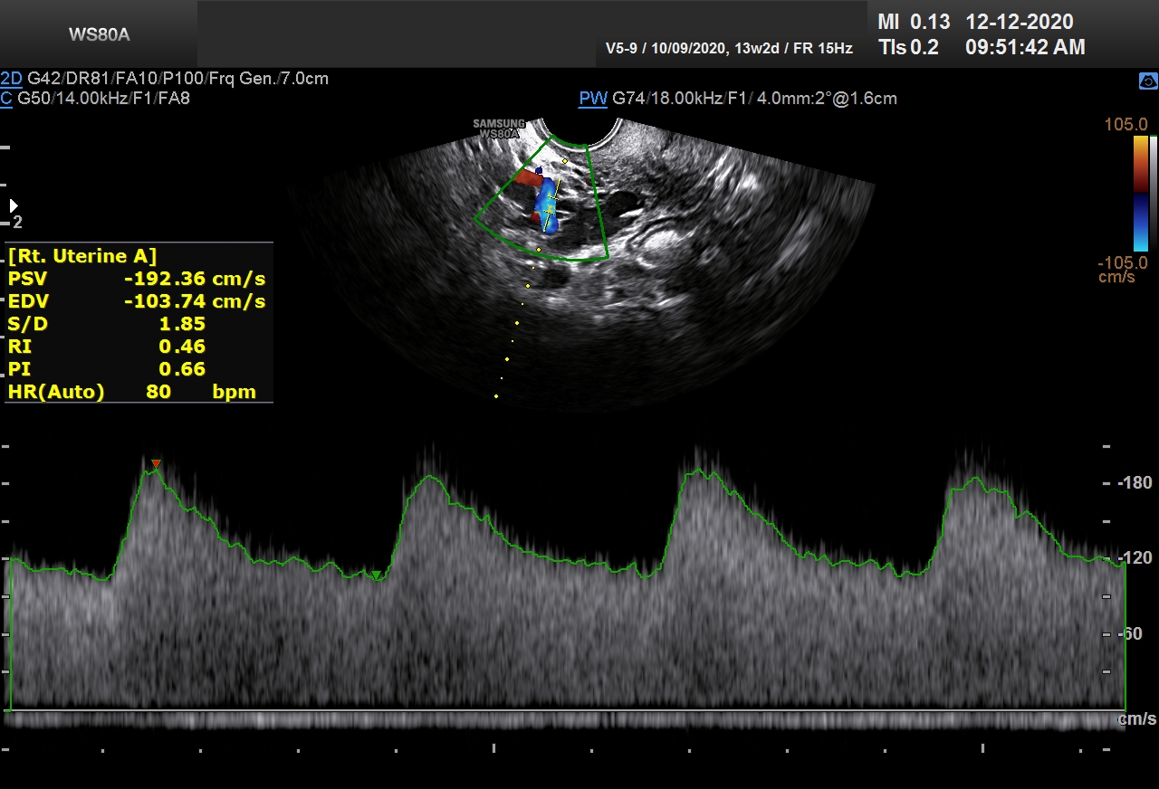 Sonography Image