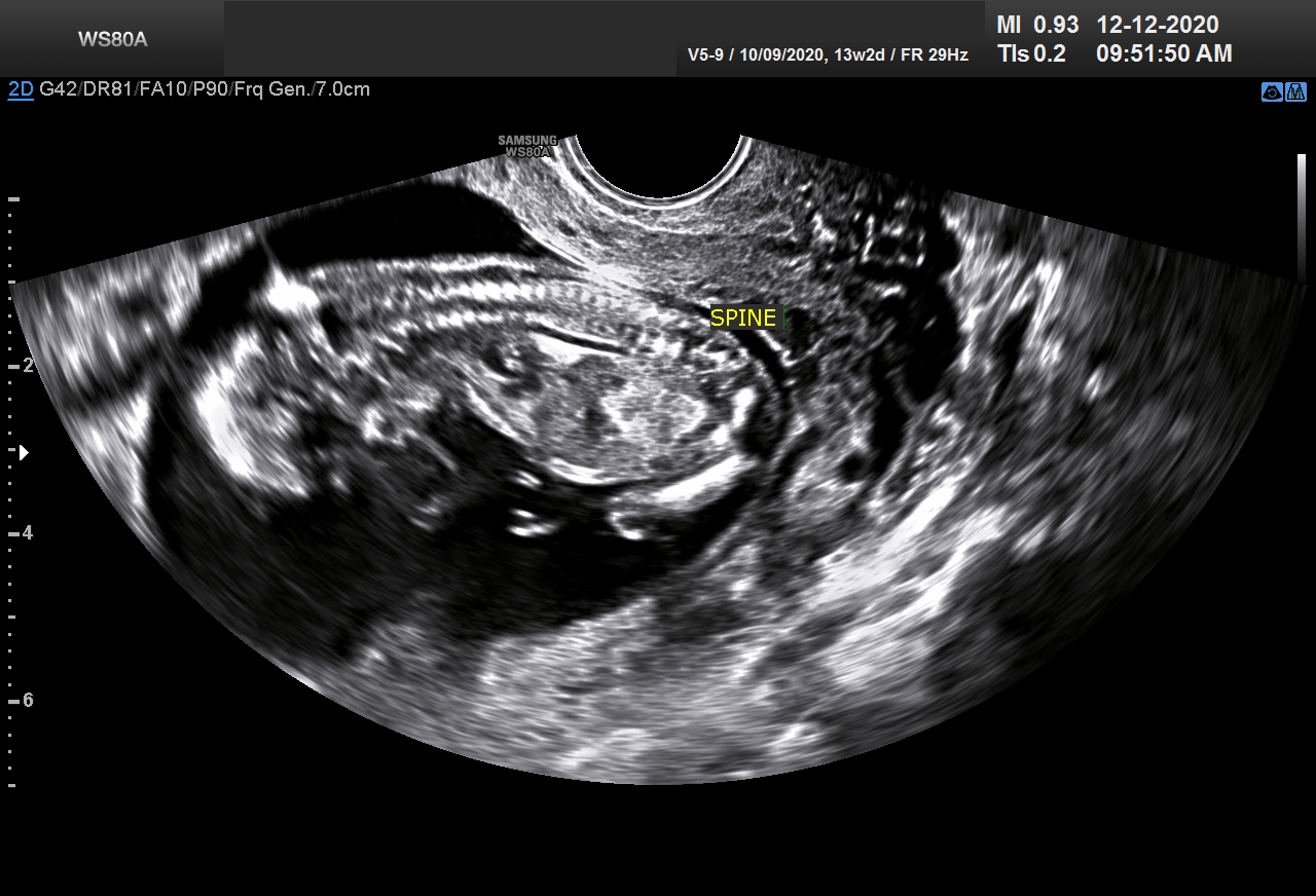 Sonography Image