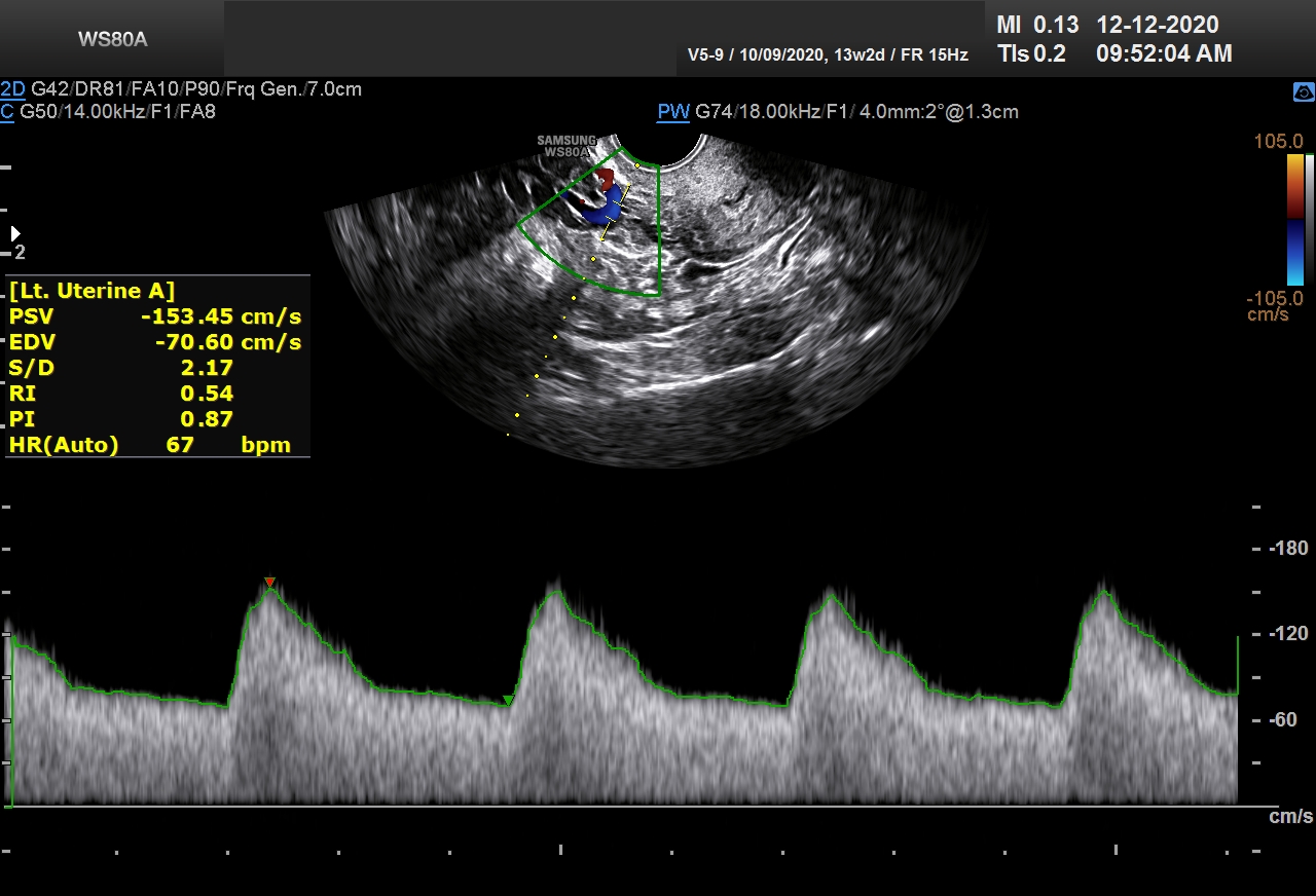 Sonography Image