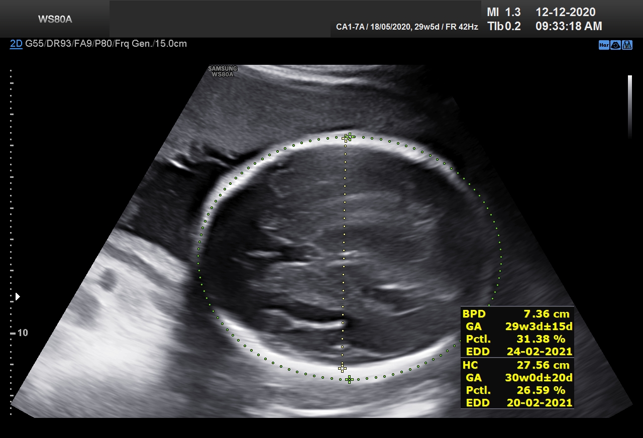 Sonography Image