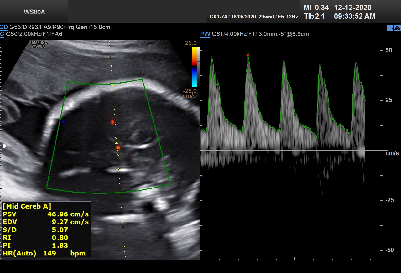 Sonography Image