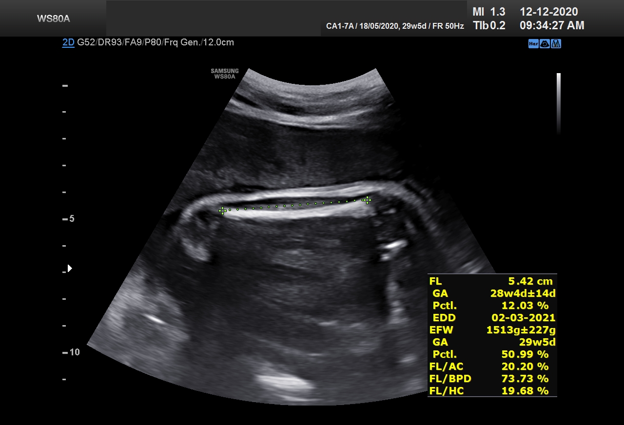 Sonography Image