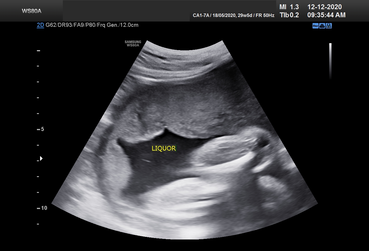 Sonography Image