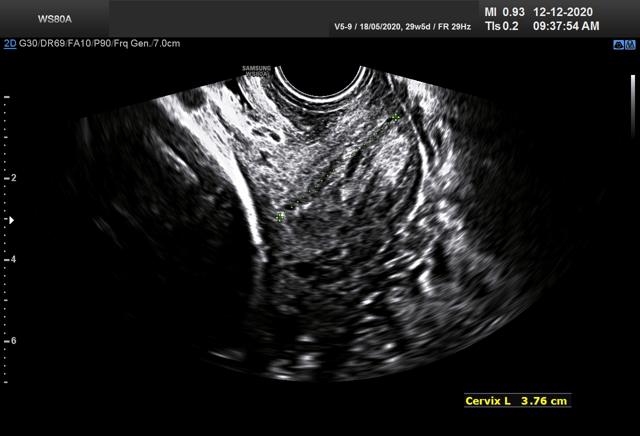 Sonography Image