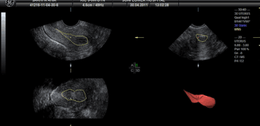 3d-4d-sonography