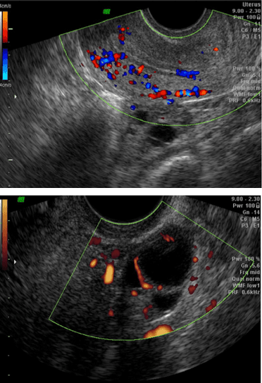 3d-4d-sonography