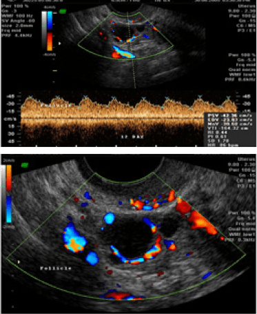 3d-4d-sonography