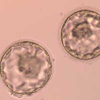 Blastocyst culture