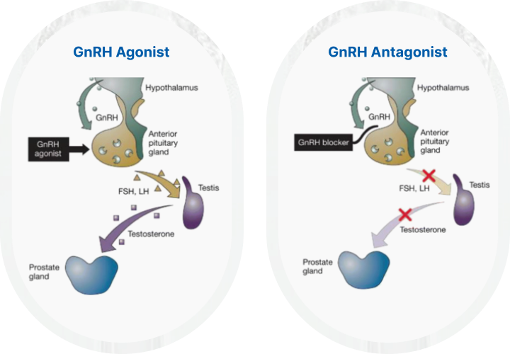 GnRH Agonist and Antagonist