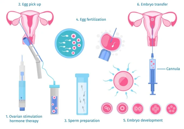 How Is The Procedure Performed?