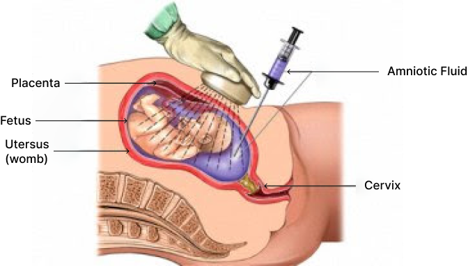 Interventional USG
