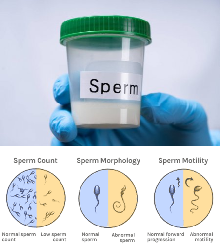 Semen analysis and blood tests
