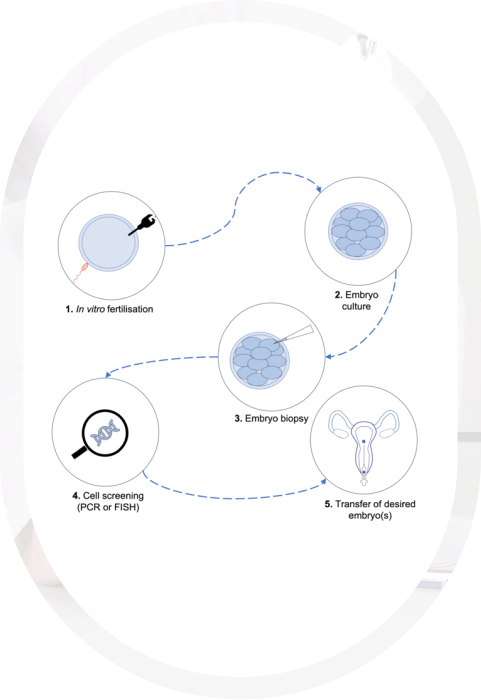 Pre implantation genetic testing (PGT)
