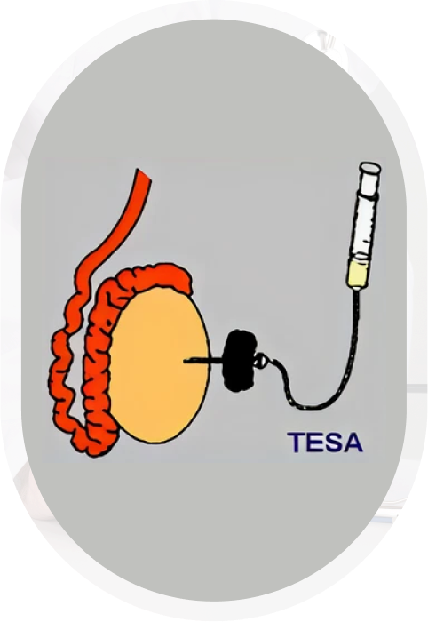 TESA