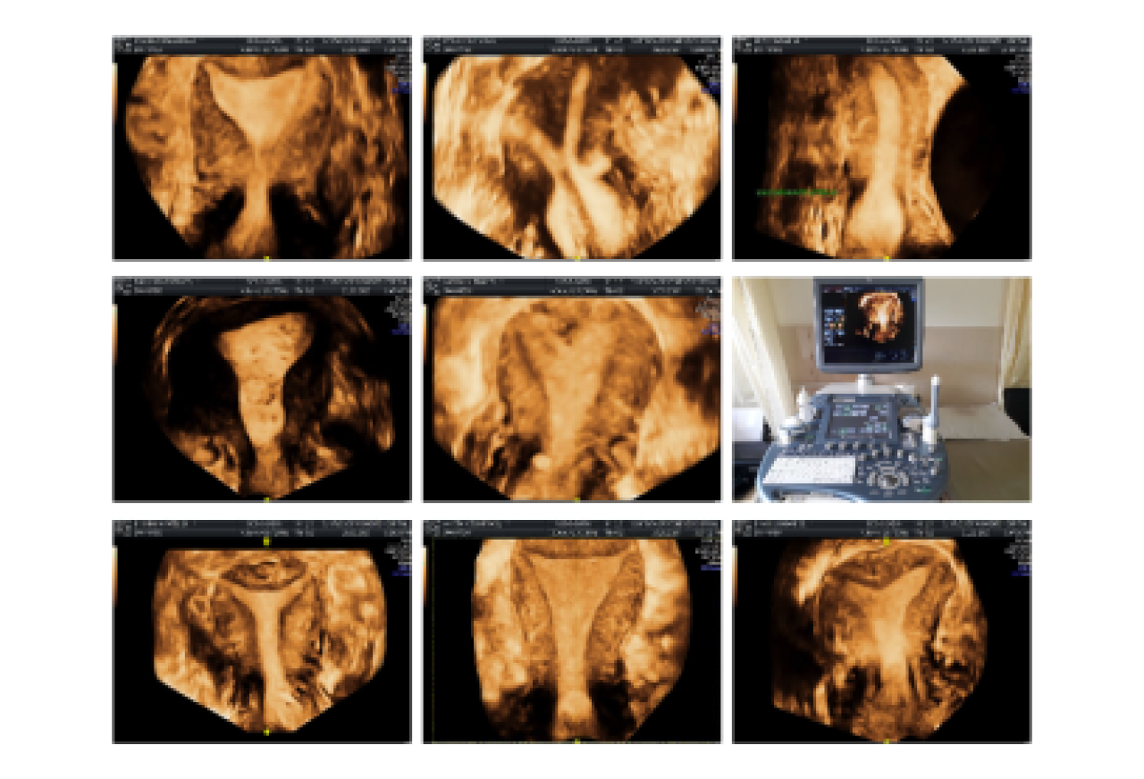 actual scan
