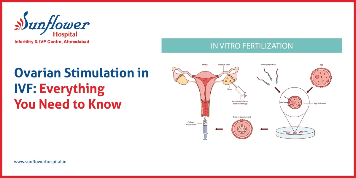 Ovarian Stimulation in IVF
