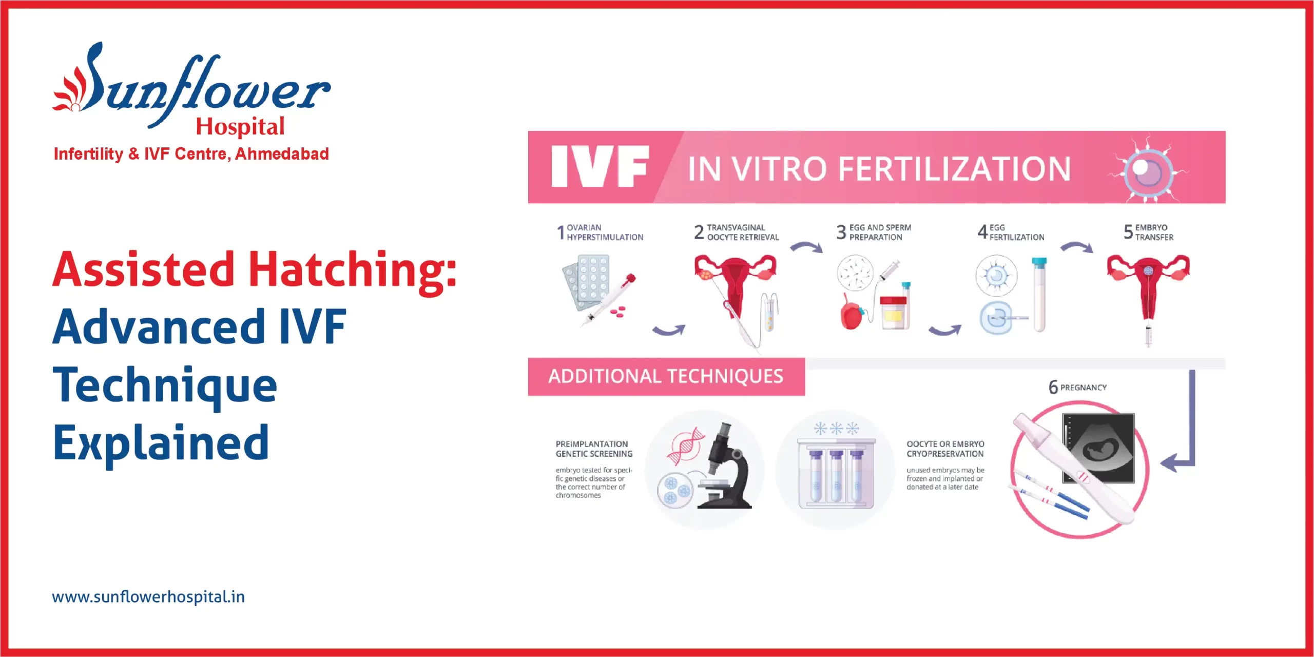 Assisted Hatching: Advanced IVF Technique Explained