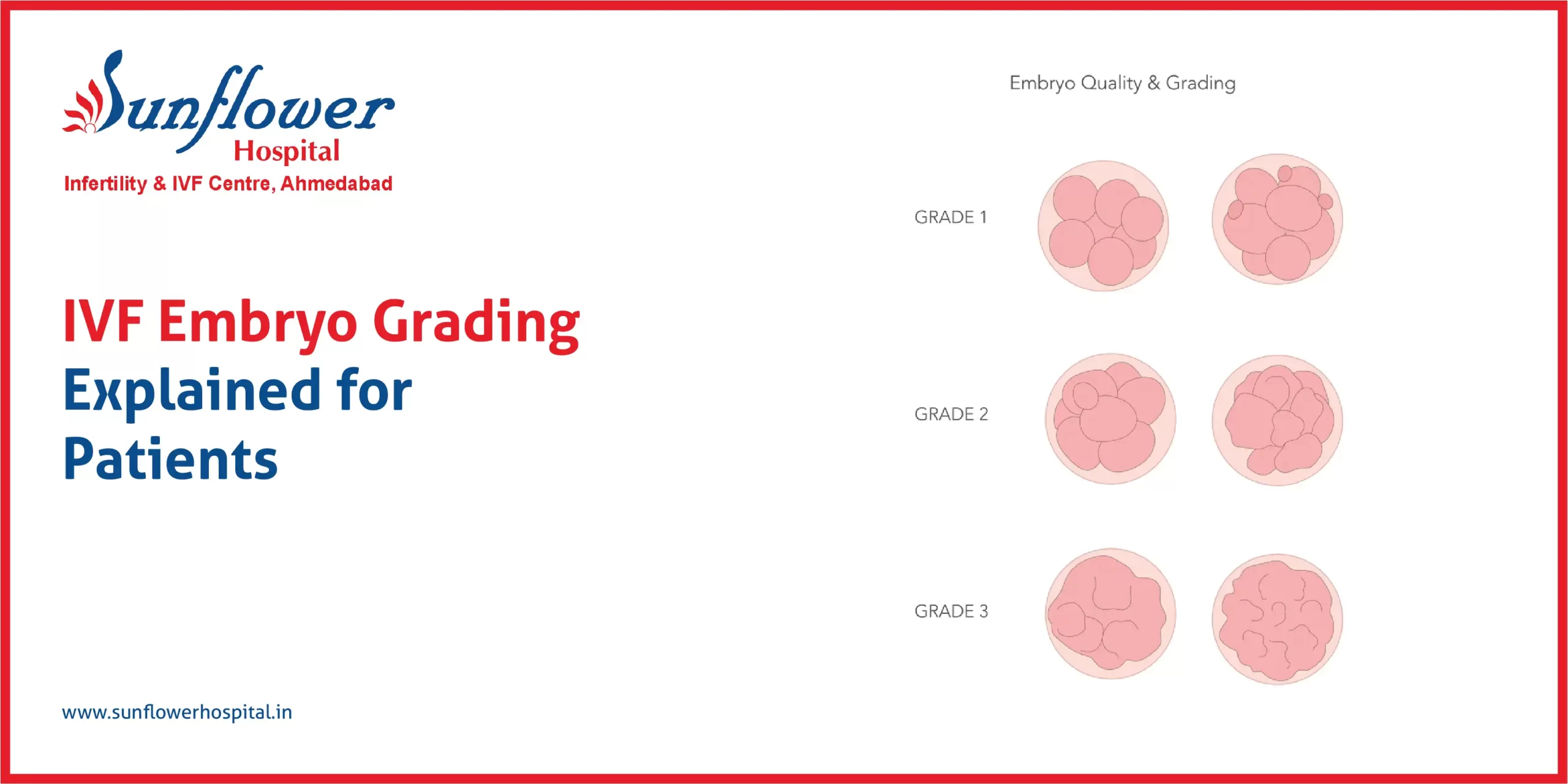 IVF Embryo Grading Explained for Patients