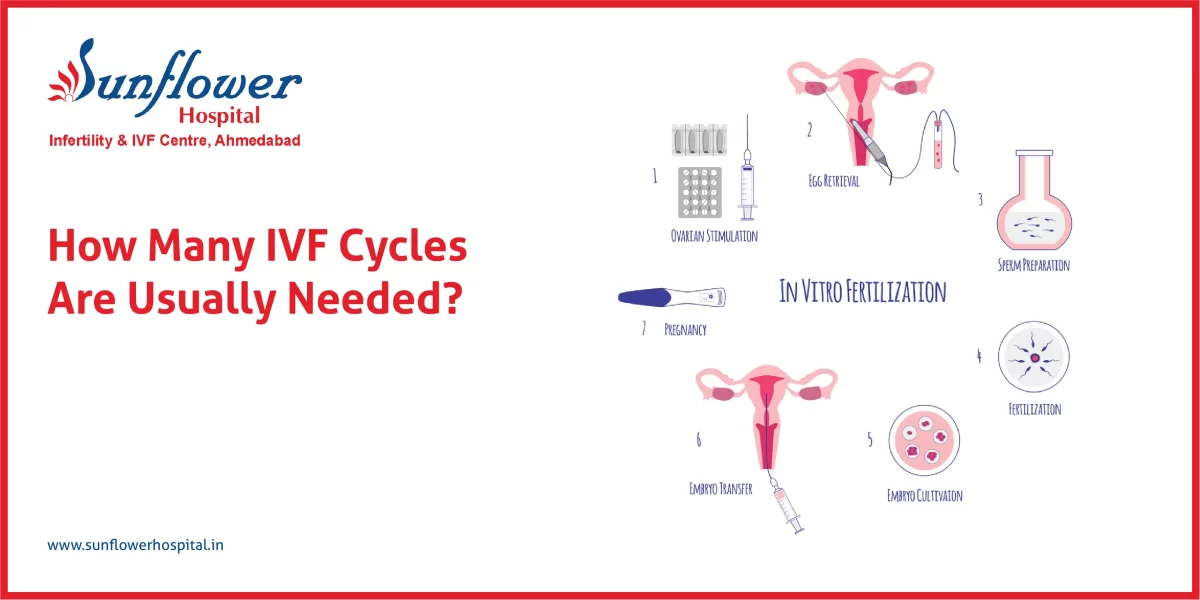 How Many IVF Cycles Are Usually Needed?