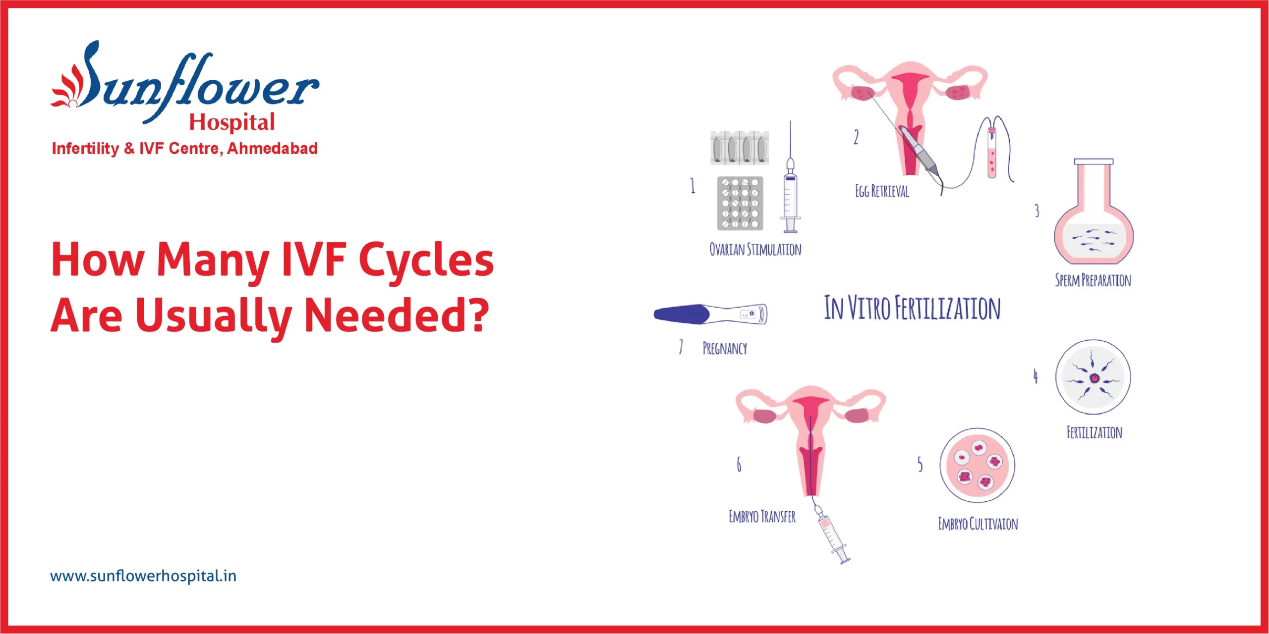 How Many IVF Cycles Are Usually Needed?