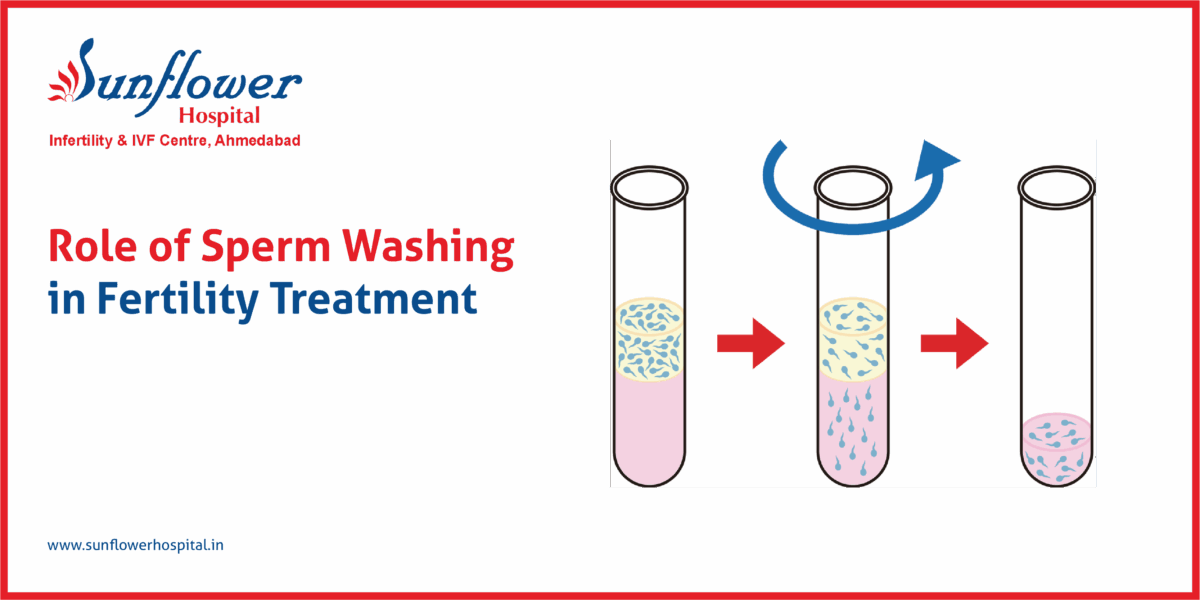 Role of Sperm Washing in Fertility Treatment